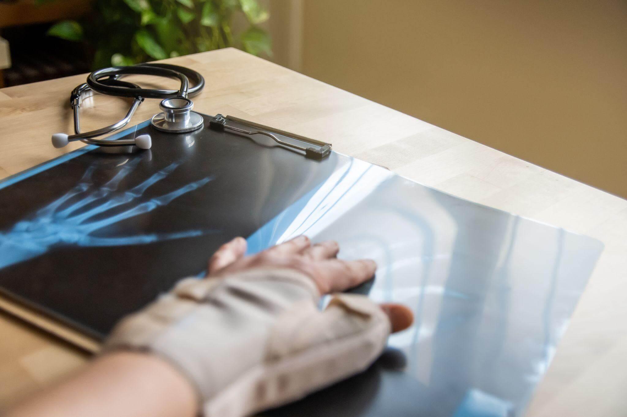 a pair of hands holding a stethoscope next to an x - ray picture